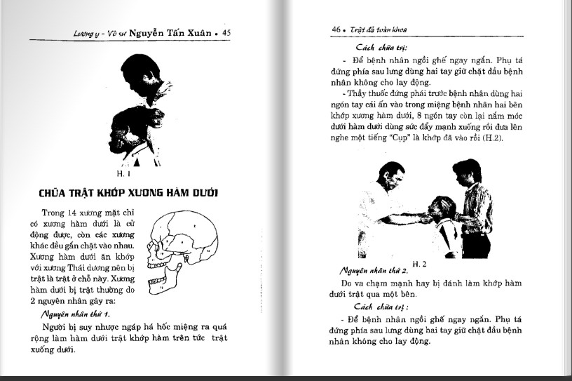trat-da-toan-khoa-3.jpg
